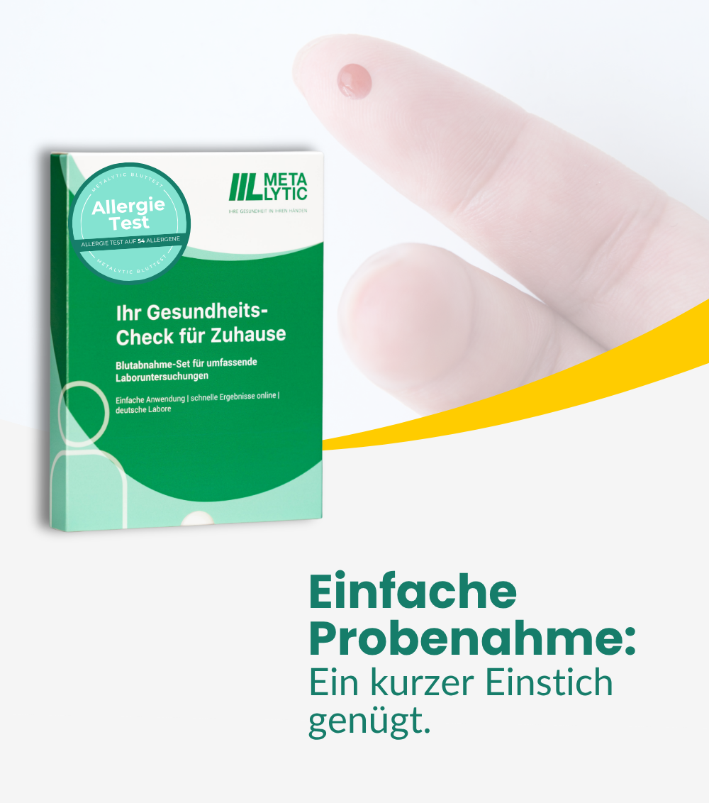 Allergie Test XL - 54 Allergene