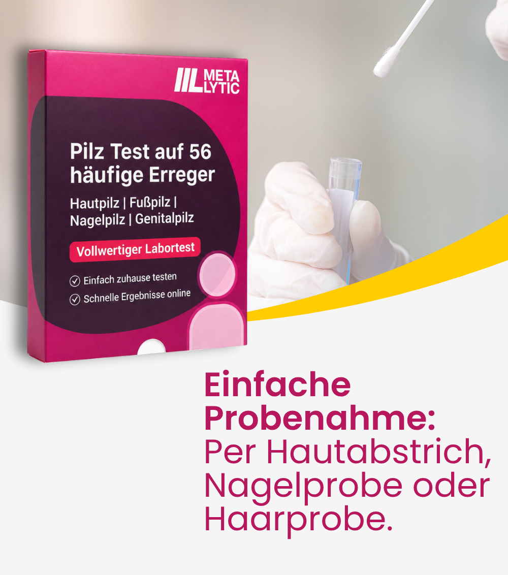 Die Probenahme mit dem Pilztest gelingt einfach per Hautabstrich, Nagelprobe oder Haarprobe.